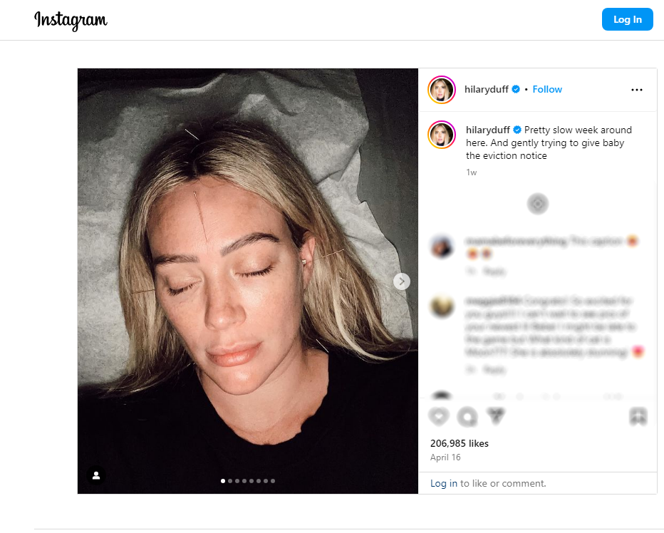 Hilary Duff Acupuncture to Induce Labor Baby News The Baby Historian