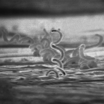 The Rise of Congenital Syphilis | Baby News (and&nbsp;History)